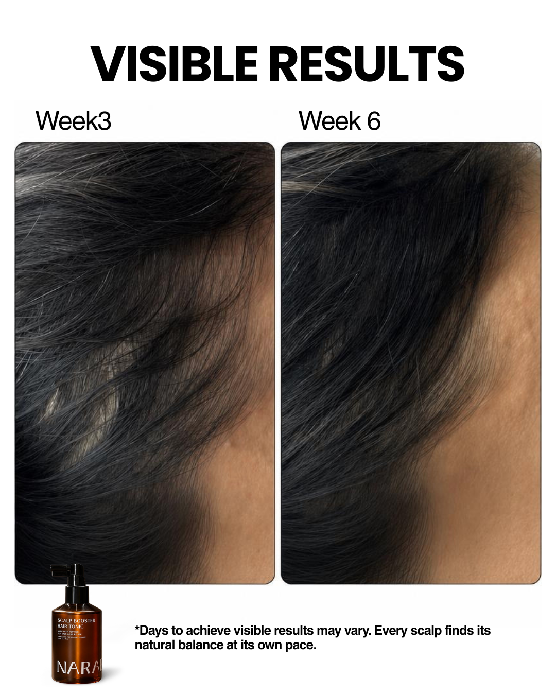 Scalp Booster Hair Tonic