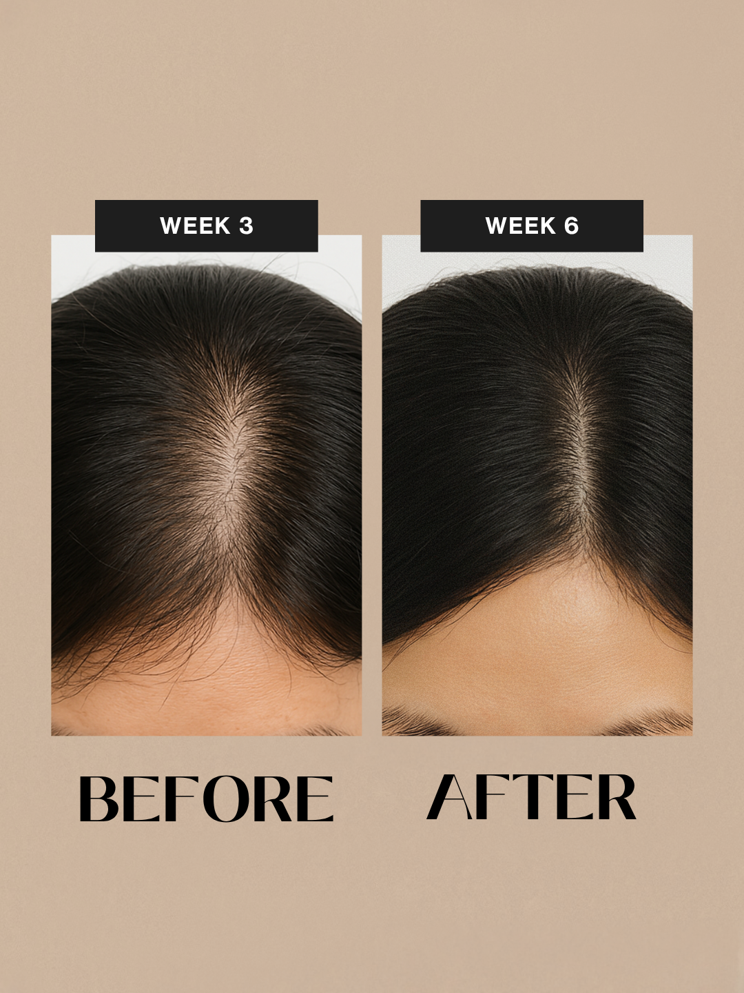 Scalp Booster Hair Tonic